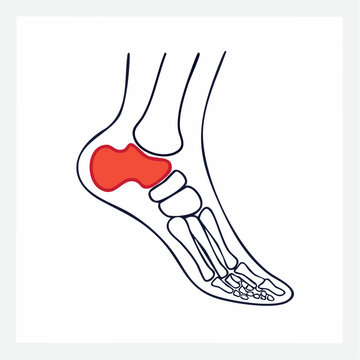 Illustration of the Calcaneus Bone in the Human Foot