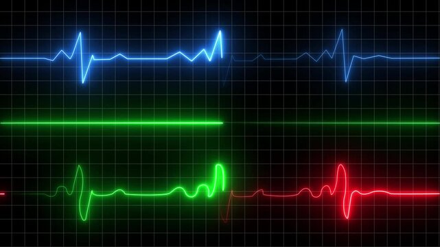 Multicolored ECG heartbeat lines on black grid background electrocardiogram medical Motion graphics of concept animation 4k video