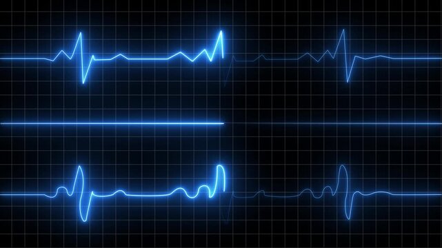 Multicolored ECG heartbeat lines on black grid background electrocardiogram medical Motion graphics of concept animation 4k video