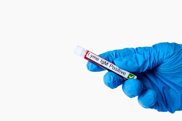 Obraz premium Lyme Disease Positive Blood Test Tube