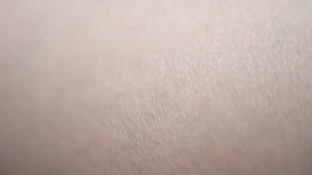 Leg skin texture close-up. Body and healthcare, hygiene and medicine concept.