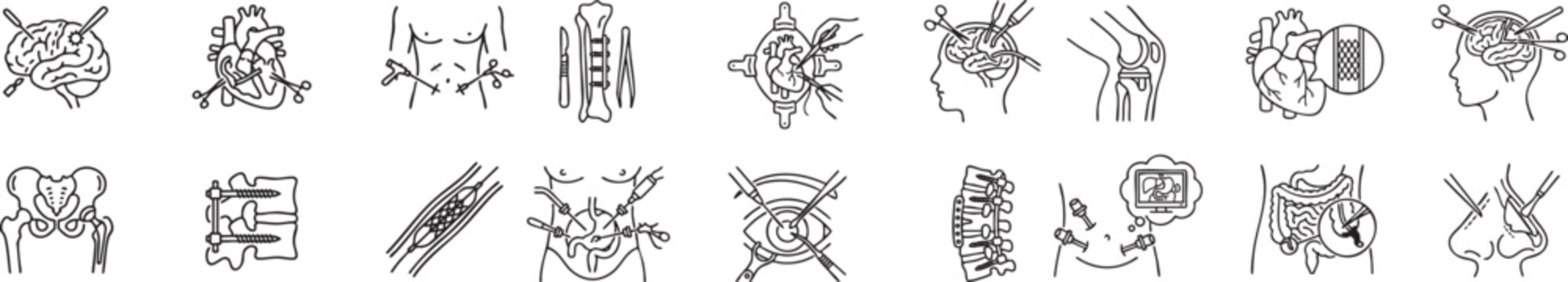 Surgical intervention icons set featuring cardiac surgery abdominal procedures bone repair and neurological operations for medical education purposes