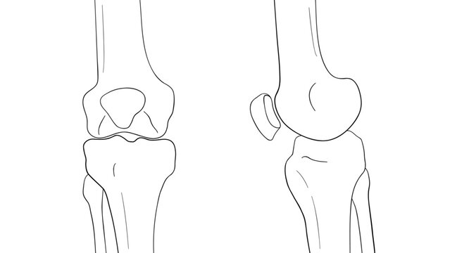 Anatomical line art illustration of the human knee joint showing frontal and lateral views. 
