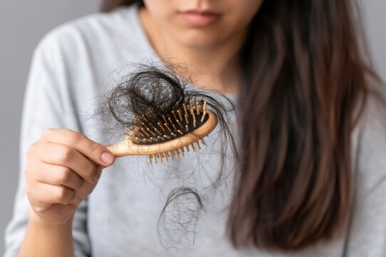 Woman holding hairbrush with excessive hair loss
