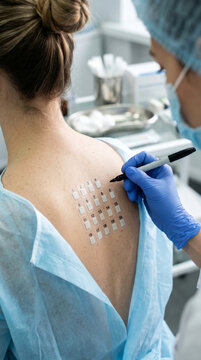 Young woman receiving an allergy patch test on her back while a healthcare professional evaluates skin reactions in a clinic