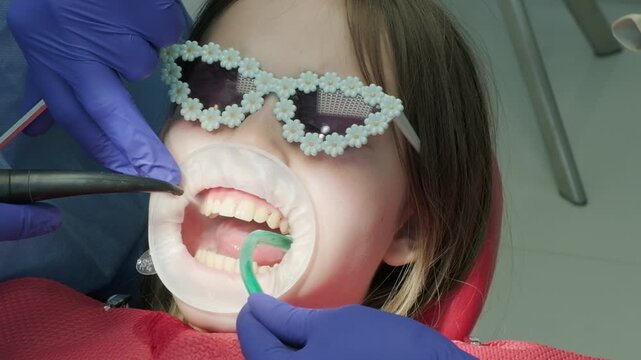 Dentist using saliva ejector tube during child treatment