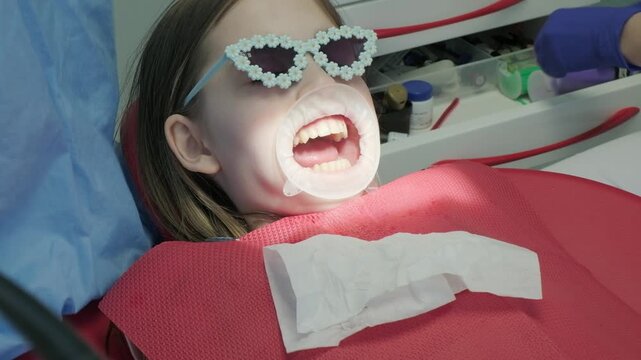 Dentist inspecting child teeth with mirror tool
