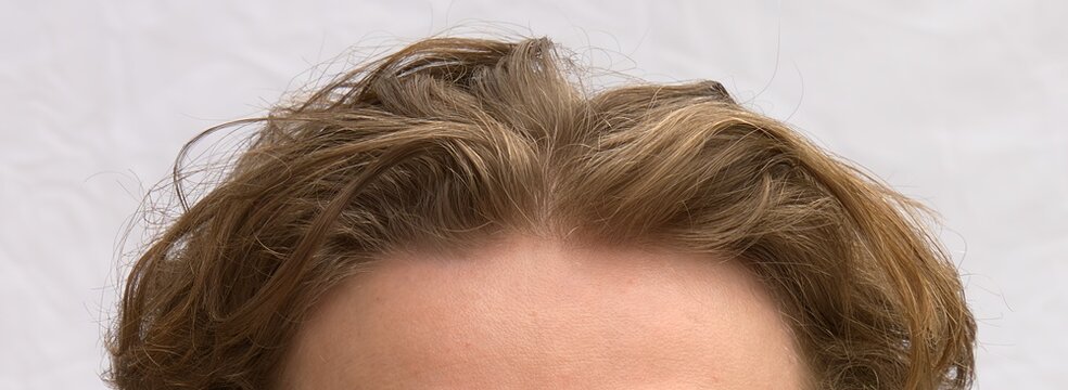 Haare und Stirn
