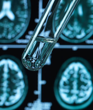 Pharmaceutical research into brain disorders including dementia and alzheimer's
