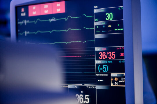 Patient monitor