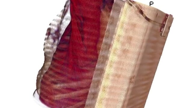 3D CT Scan Volume Rendering 7 Showing Human Thorax Muscle Tissue Layer over Rib Cage and Chest Anatomy
