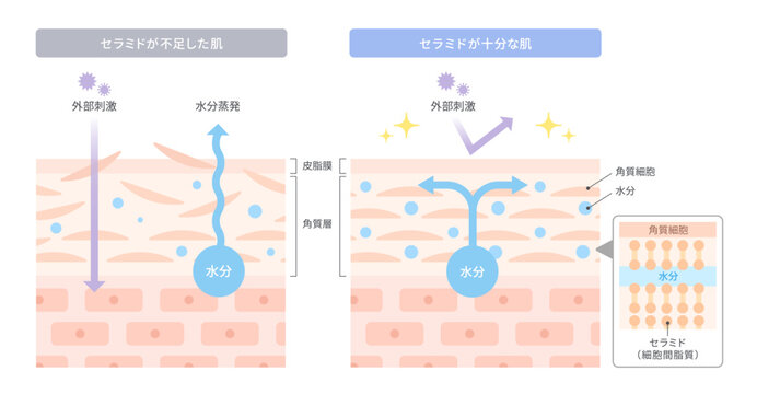 セラミド不足の肌とセラミドが十分な肌の比較イラスト｜肌の保湿機能を解説する断面図