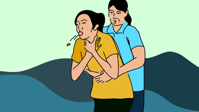rescuing a choking patient, color vector illustration