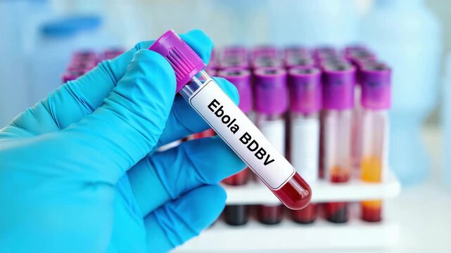 Scientist holding vacuum tube with Ebola BDBV specimen in front of rack for hemorrhagic fever diagnostics and viral outbreak laboratory screening under epidemic preparedness programs