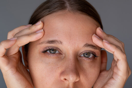 Close-up of a young woman touching forehead wrinkles caused by facial expressions on a grey background. Aging signs, fine lines and skincare concern concept
