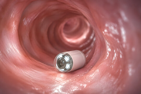 Advanced capsule endoscopy device navigating the digestive tract in a realistic medical visualization, representing non-invasive screening, preventive healthcare and innovative diagnostic technology.
