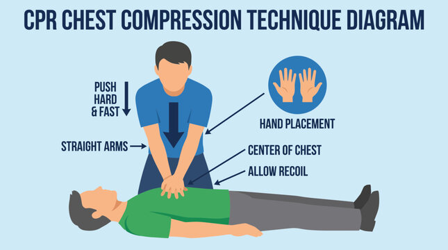 Cardiopulmonary Resuscitation CPR Chest Compression Technique Diagram