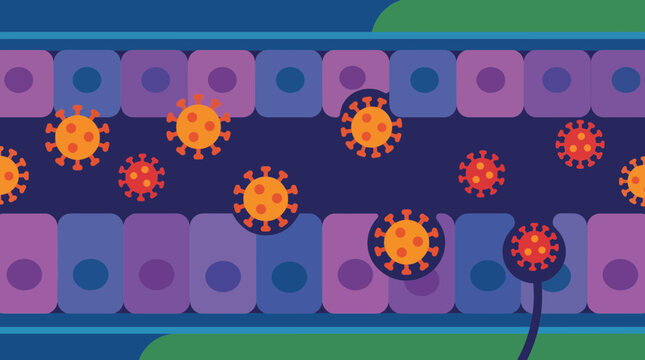 Respiratory Syncytial Virus Infecting Bronchiolar Epithelial Cells