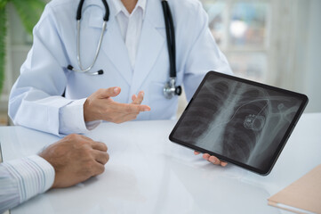 cardiothoracic surgeon looks medical x-ray image of pacemaker implantation cardioverter...