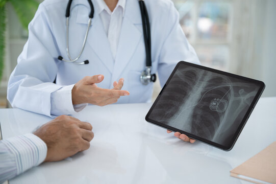 cardiothoracic surgeon looks medical x-ray image of pacemaker implantation cardioverter defibrillator in chest patient at hospital.