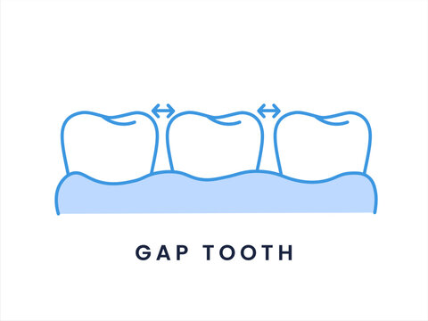 Gapped Teeth Dental Condition Illustration. Diastema Tooth Alignment Flat Dental Icon.