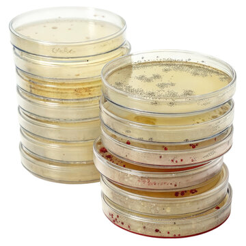 Stack of dirty petri dishes showing different microorganisms on a white background isolated like a png file
