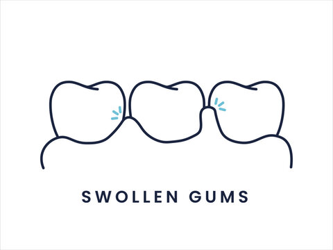 Gum Inflammation and Swollen Gums Dental Condition Outline Icon. Tooth and Gingivitis Problem Flat Dental Icon Set.