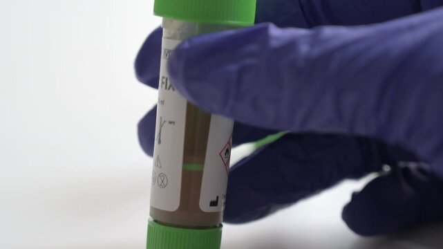 Lab technician with blue gloves taking a stool test tube from a table on a white background