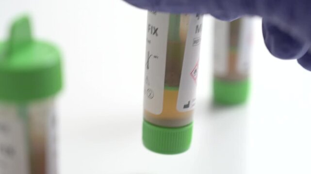 Laboratory assistant hand in a blue glove removing a stool test tube isolated on a white background