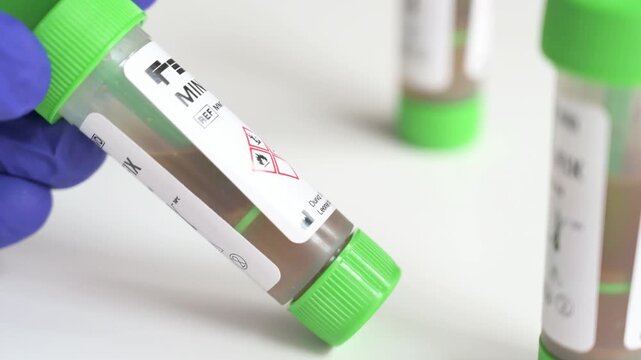 Scientist handling a stool sample test tube on a white background in a laboratory for medical analysis