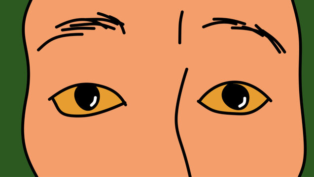 Man's face with jaundice, color vector illustration