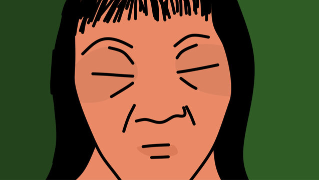 Puffiness under the eyes, color vector illustration