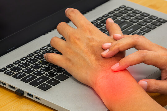 Office worker with wrist pain, red inflammation, orthopedic therapy concept.