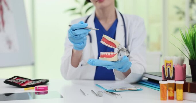 Female dentist demonstrates human jaws model at workplace. Woman doctor explains oral cavity hygiene importance in stomatology clinic slow motion