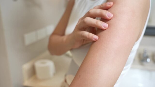 skin problem and beauty. Young woman scratch body has itchy skin from skin allergic, steroid allergy, sensitive skin, red from sunburn, chemical allergy, rash, insect bites, Seborrheic Dermatitis.