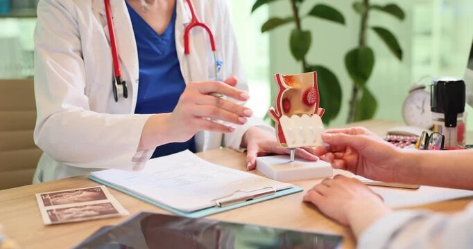 Doctor hands suppositories and shows human rectum model to patient in hospital. Woman proctologist helps woman to cure hemorrhoids at appointment