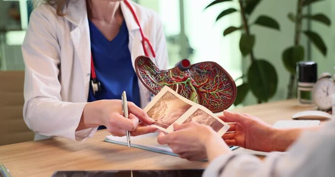 Doctor holds human liver model and gives ultrasound images to patient in clinic. Physician consults woman with test result in hospital slow motion