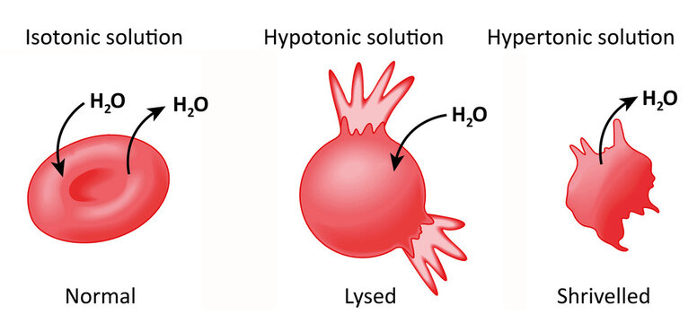 Osmotic Pressure Effect on Red Blood Cells: Isotonic, Hypotonic, and Hypertonic Solutions.