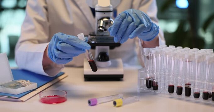 Assistant in gloves places test tube with blood onto rack in medical lab. Female doctor analyzes patients samples with microscope in laboratory
