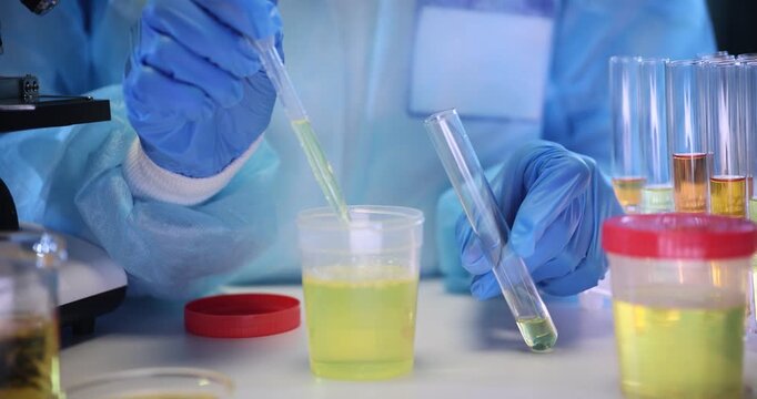 Healthcare worker takes out urine sample from plastic flask to test tube on table. Doctor uses pipette working with yellow liquid in laboratory
