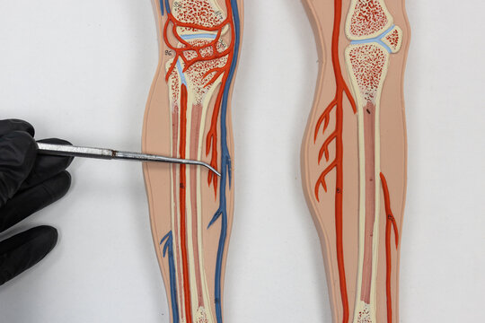 Pointer Showing The Lower Great Saphenous Vein On Human Anatomy Model