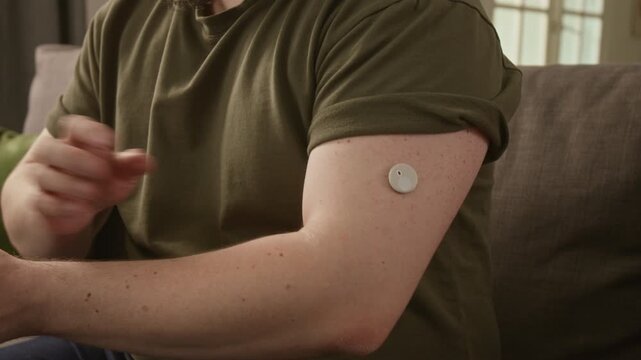 Close up on Caucasian young adult man scanning continuous glucose monitor sensor on arm using smartphone. Video suits diabetes care campaigns and digital health technology advertisements