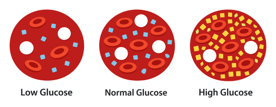Blood glucose levels illustration showing different concentrations of sugar molecules in the bloodstream, indicating hypoglycemia, normal, and hyperglycemia