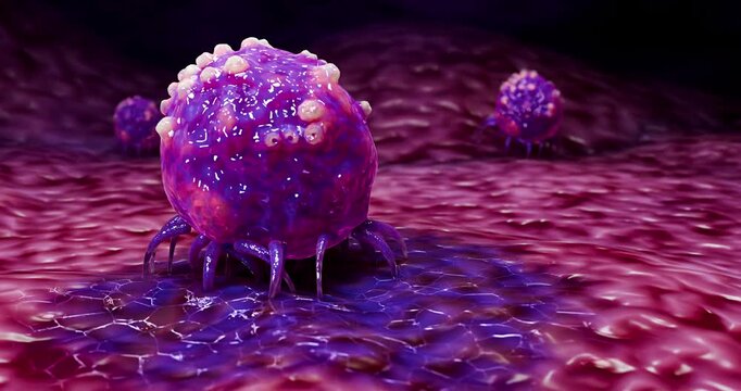 Cancer Cell Invasion and Metastasis Developing Across Human Tissue Surface 3D Rendering
