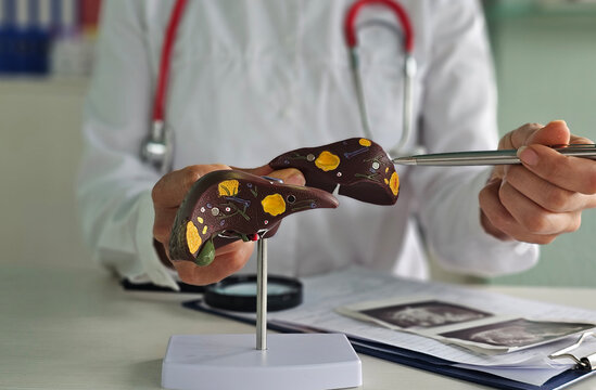 Doctor shows model of liver during medical consultation in clinic setting
