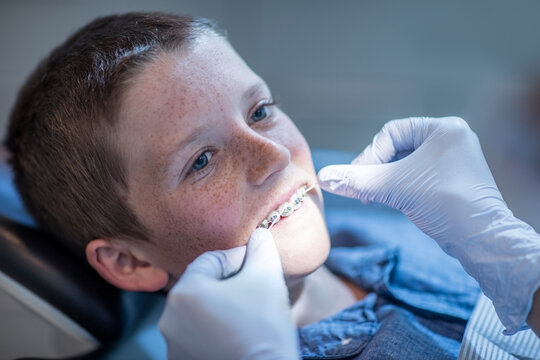 Boy with braces in dental surgery receiving dental floss treatment