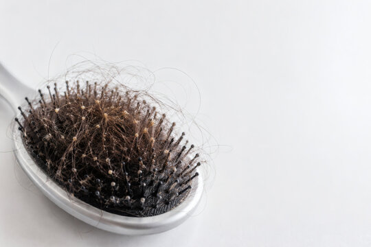 Excessive Hair Shedding Collected in Hairbrush Close Up