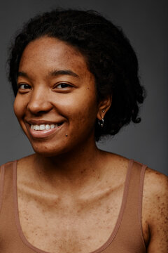 Smiling woman with acne scars against gray background