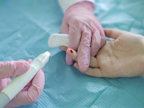 A doctor tests for diabetes using a finger lancet to measure blood sugar levels. Blood tests and diseases concept