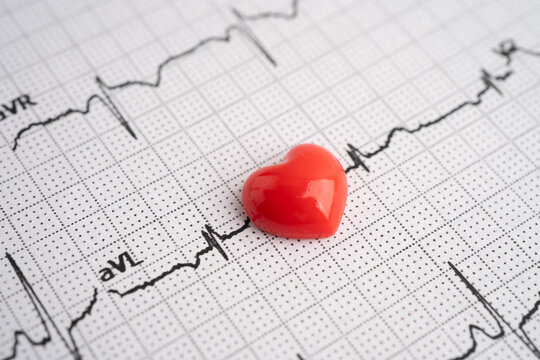 Electrocardiogram ECG, heart wave, heart attack, cardiogram report.